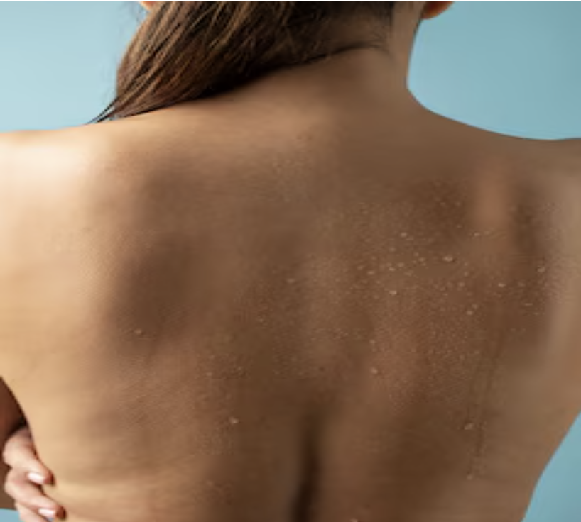 Back & Body